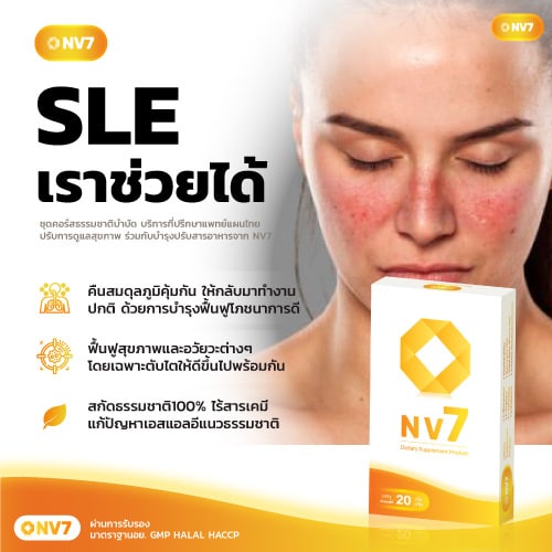 SLE โรคเอสแอลอี
